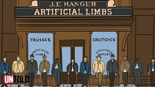 Civil War Prosthetics: A Step Forward in Battlefield Medicine